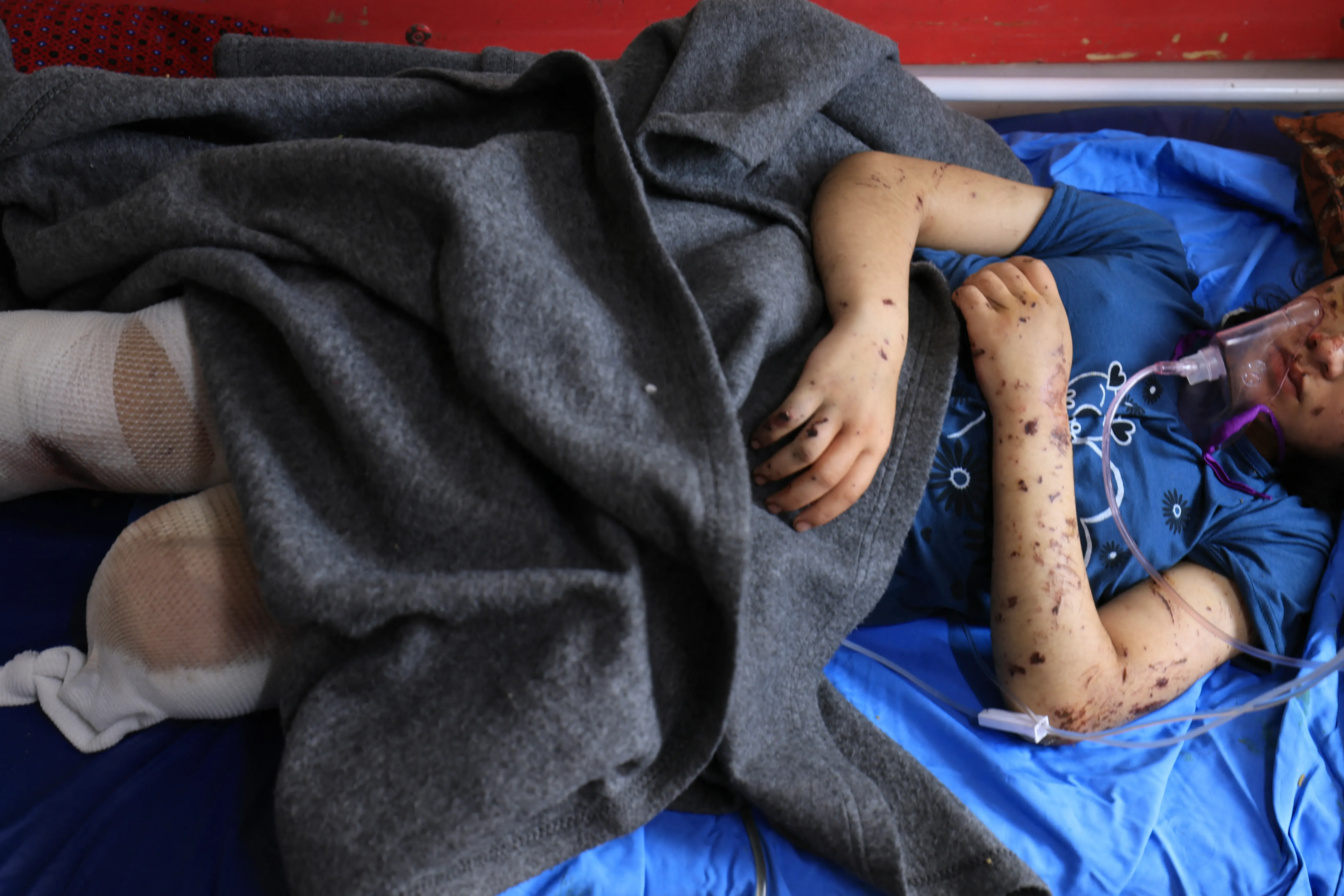 Hope for Healing: Supporting Palestinian Children's Medical Care